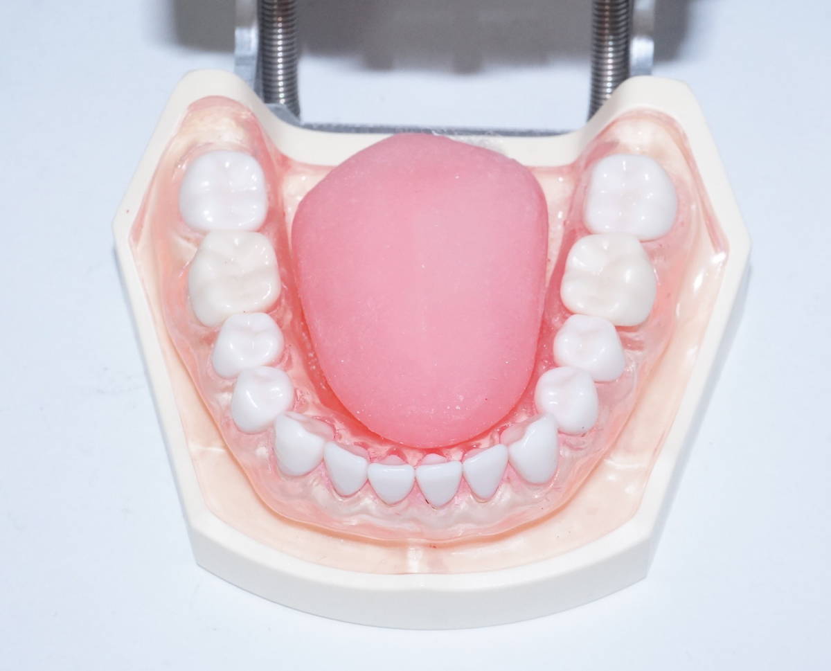 NISSIN 歯周病 歯科 模型 歯周外科 顎模型 歯科衛生士 ニッシン