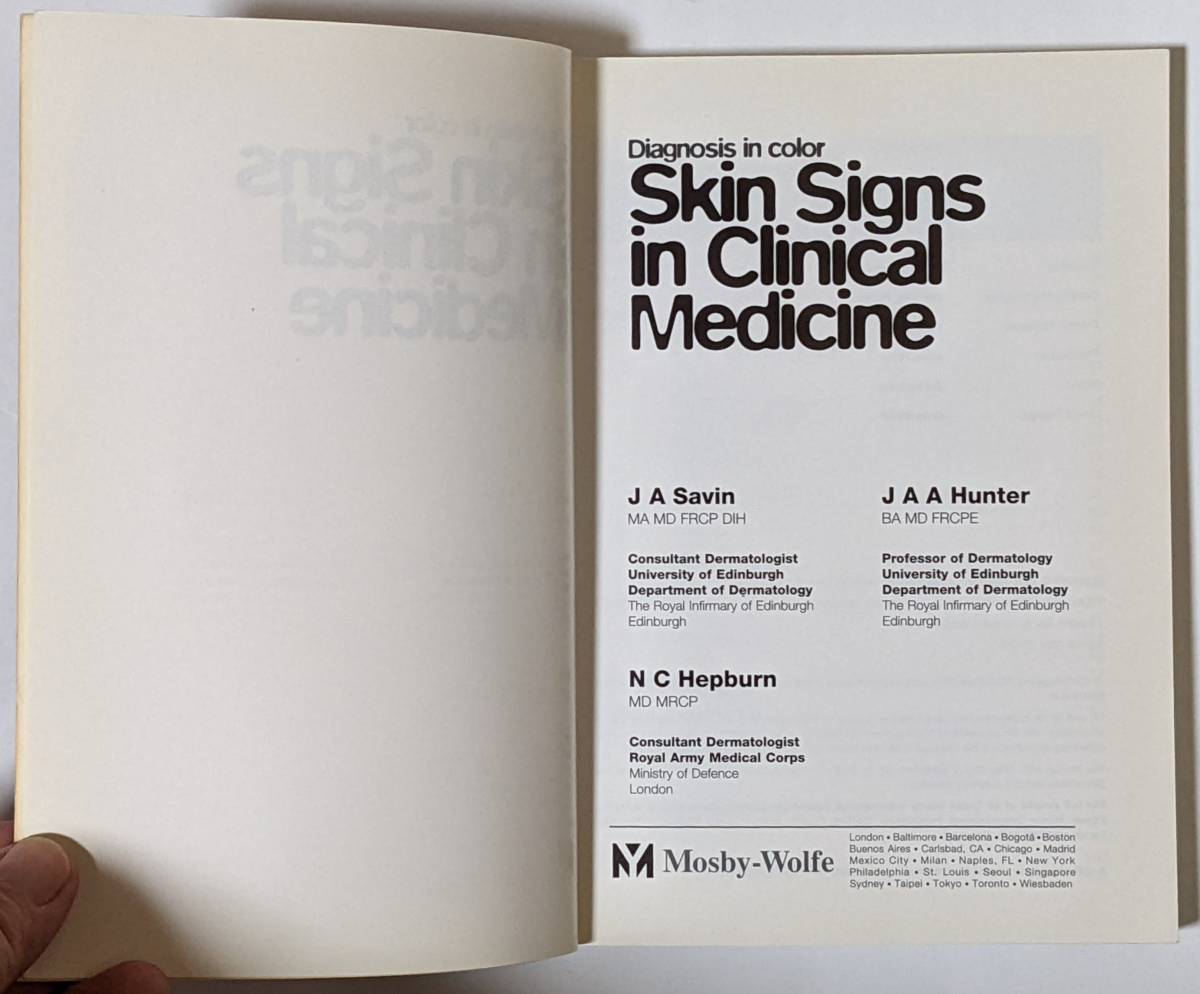 皮膚に現れる兆候から全身性疾患を診断するテキスト[Skin Signs in Clinical Medicine]英語/1997年発行/カラー図版/乾癬/湿疹_画像4