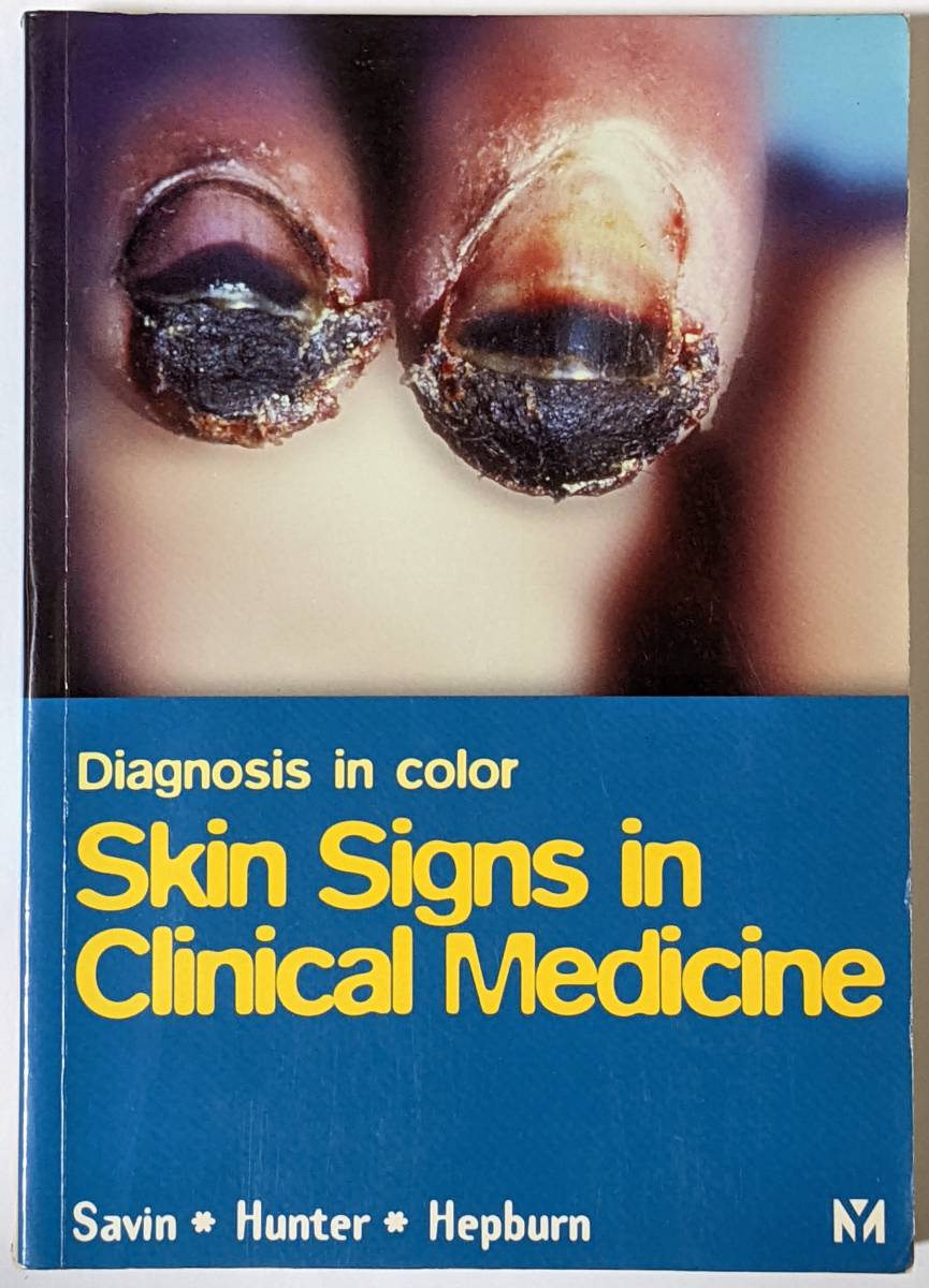 皮膚に現れる兆候から全身性疾患を診断するテキスト[Skin Signs in Clinical Medicine]英語/1997年発行/カラー図版/乾癬/湿疹_画像1