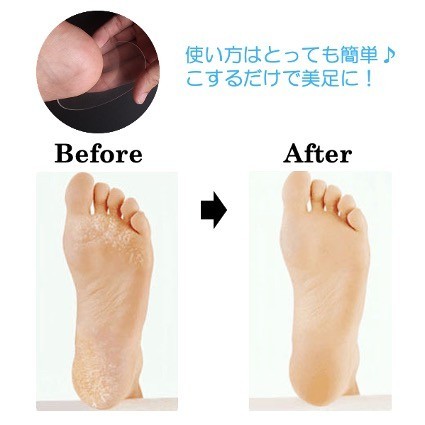  heel angle quality dropping angle quality removal angle quality taking . foot care beautiful pair beautiful legs 