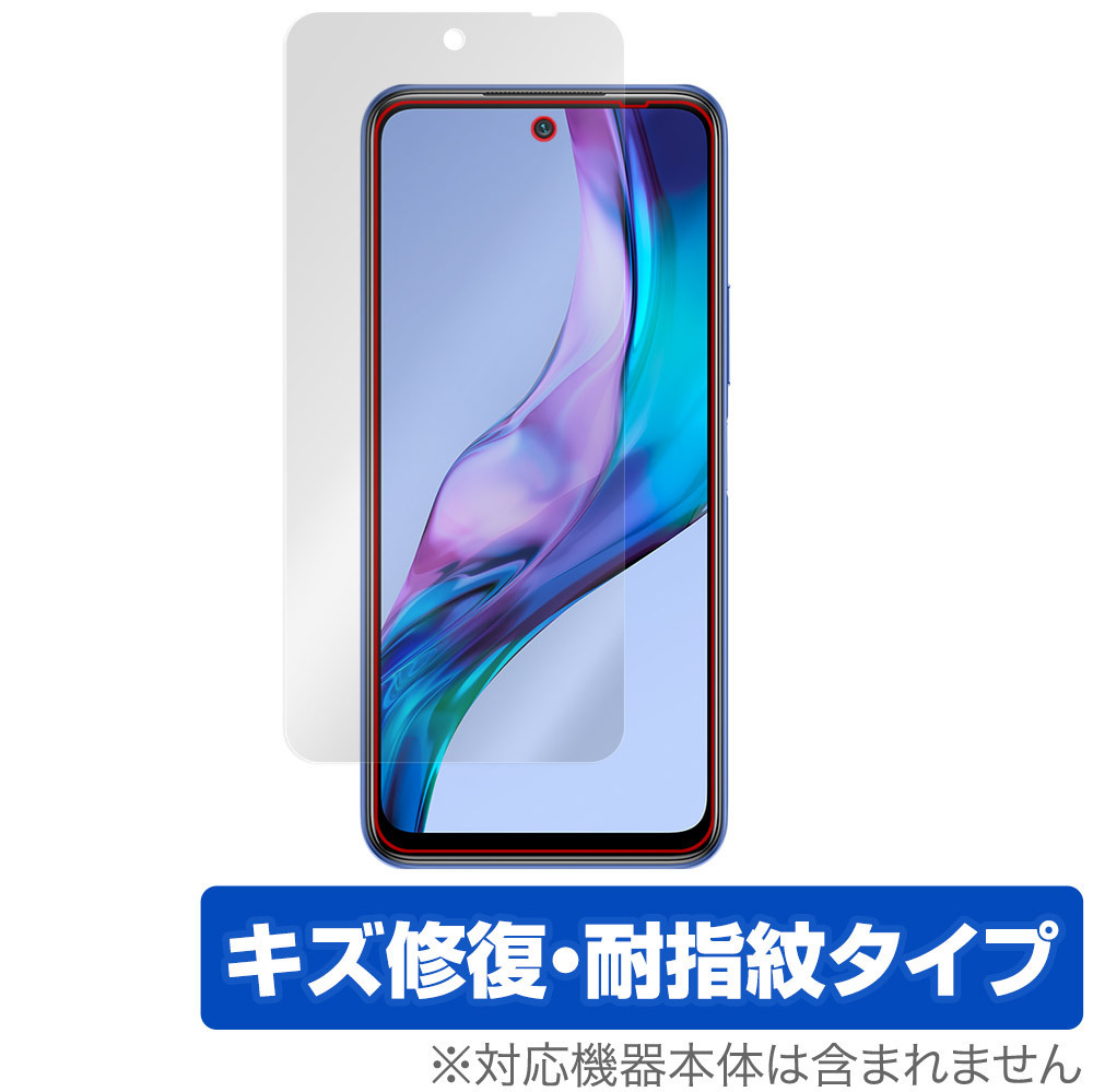 Xiaomi Redmi Note 10T 保護 フィルム OverLay Magic for シャオミー レドミ ノート 10T 液晶保護 キズ修復 耐指紋 防指紋 コーティング_画像1