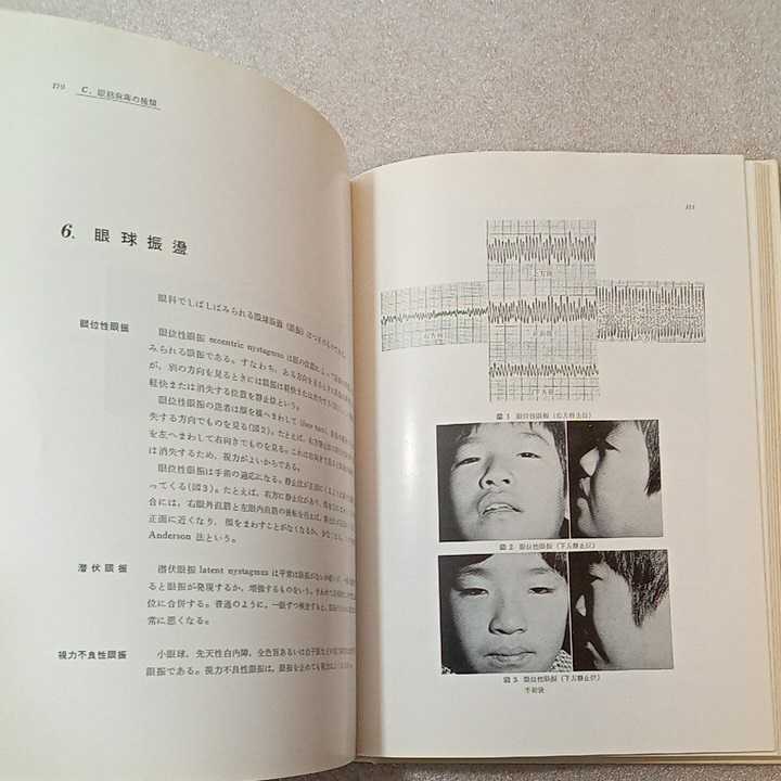 zaa-322 斜視・弱視診療アトラス 丸尾 敏夫 / 久保田 伸枝(著 zaa-322 斜視・弱視診療アトラス 丸尾 敏夫 / 久保田 伸枝(著