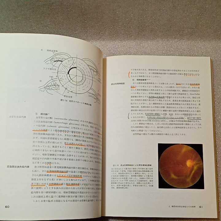 zaa-326♪糖尿病眼科学 　福田 雅俊 (著)　医学書院　単行本 1986/1/1