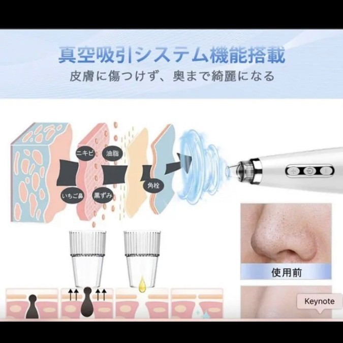 毛穴吸引器 5種類の吸引ヘッド 肌美顔器 5段階吸引力 真空吸引　LED表示