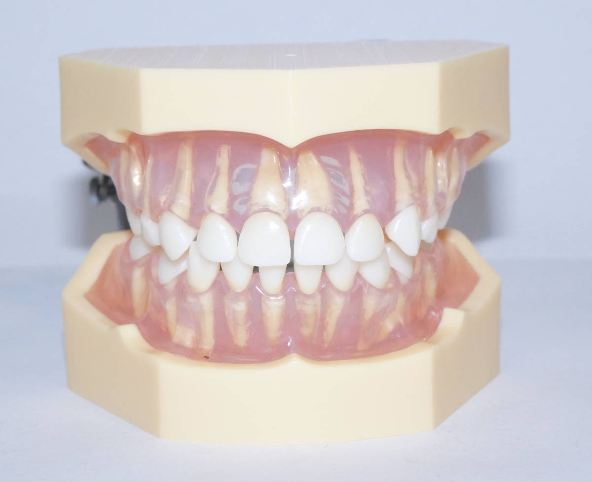 NISSIN 複製歯牙着脱顎模型 乳歯 I31D-400F 小児 歯科 模型 顎模型