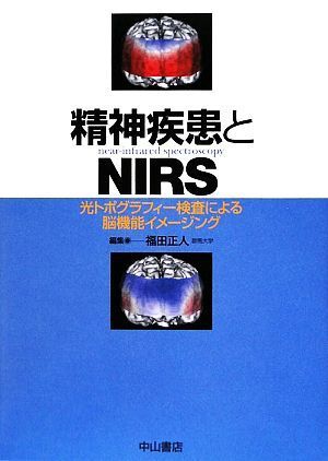 精神疾患とＮＩＲＳ 光トポグラフィー検査による脳機能イメージング／福田正人【編】_画像1