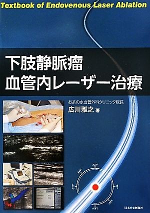 下肢静脈瘤血管内レーザー治療／広川雅之【著】_画像1