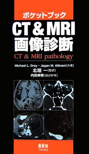 ポケットブック　ＣＴ＆ＭＲＩ画像診断／Ｍｉｃｈａｅｌ　Ｌ．Ｇｒｅｙ，Ｊａｇａｎ　Ｍ．Ａｉｌｉｎａｎｉ【共著】，北垣一【監訳】，内田_画像1