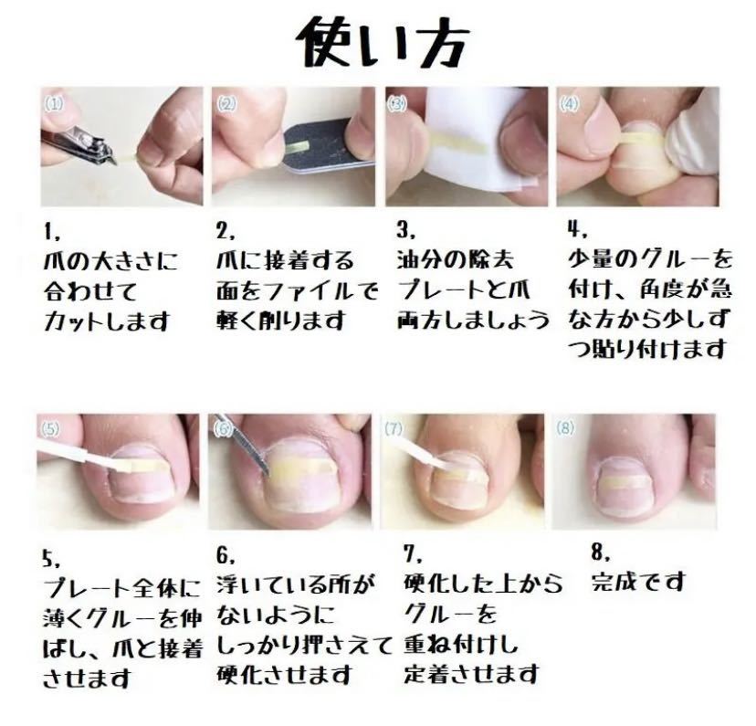 ヤフオク 陥入爪 巻き爪 治療 矯正 治す 足 ネイル 3mm幅