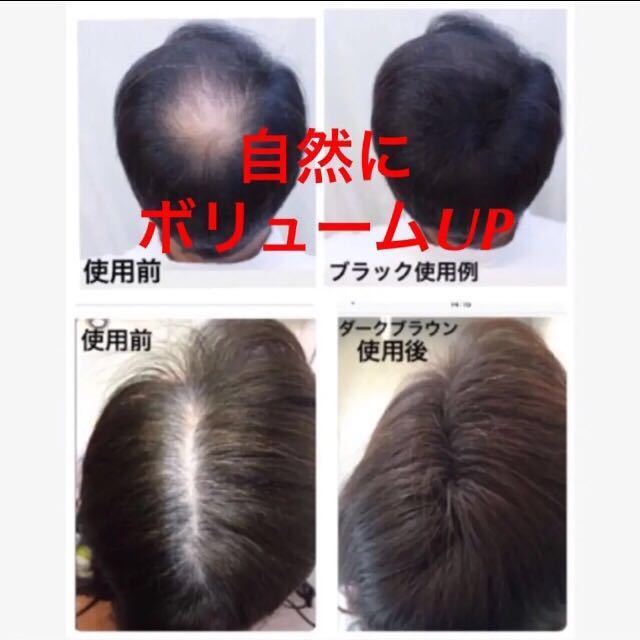 増毛パウダーふりかけヘアー白髪つむじ薄毛隠し生え際などスーパーミリオンヘアーより安いマイクロヘアーパウダーボトル＆詰替えセット