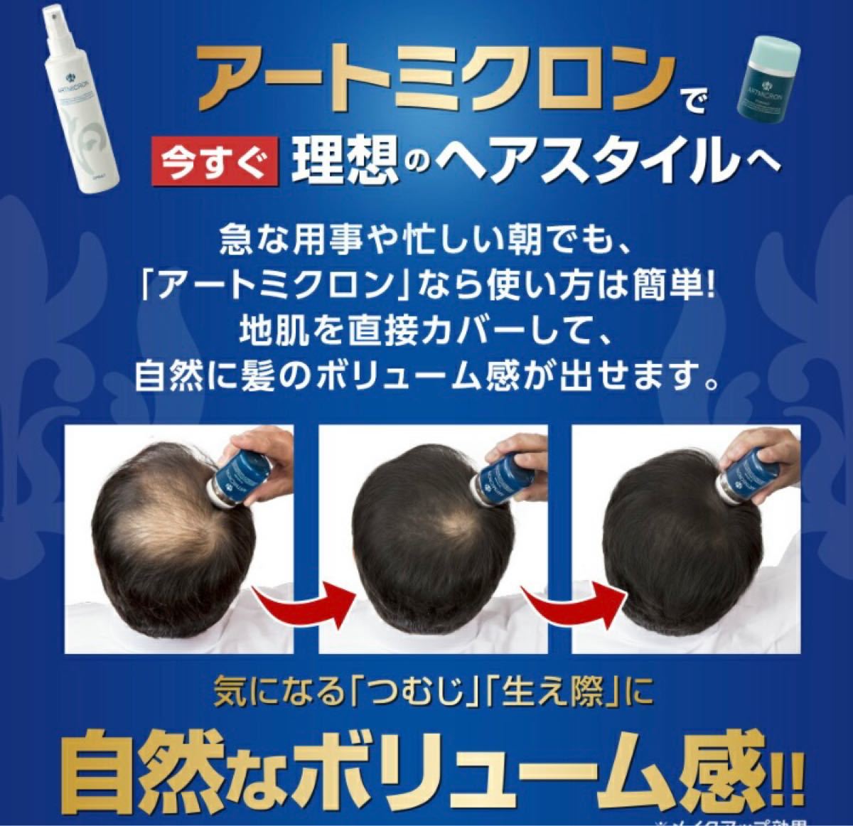 アートネイチャー アートミクロンパウダー 20g 増毛パウダー ヘアファンデーション パフ 白髪隠し ナチュラルブラック ブラック