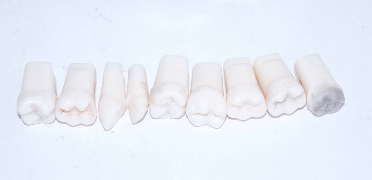 NISSIN 歯周病 歯科 模型 歯周外科 顎模型 歯科衛生士 ニッシン スケーリング スケーラー SRP 歯石 マネキン 超音波 ペリオ 舌 4_画像3