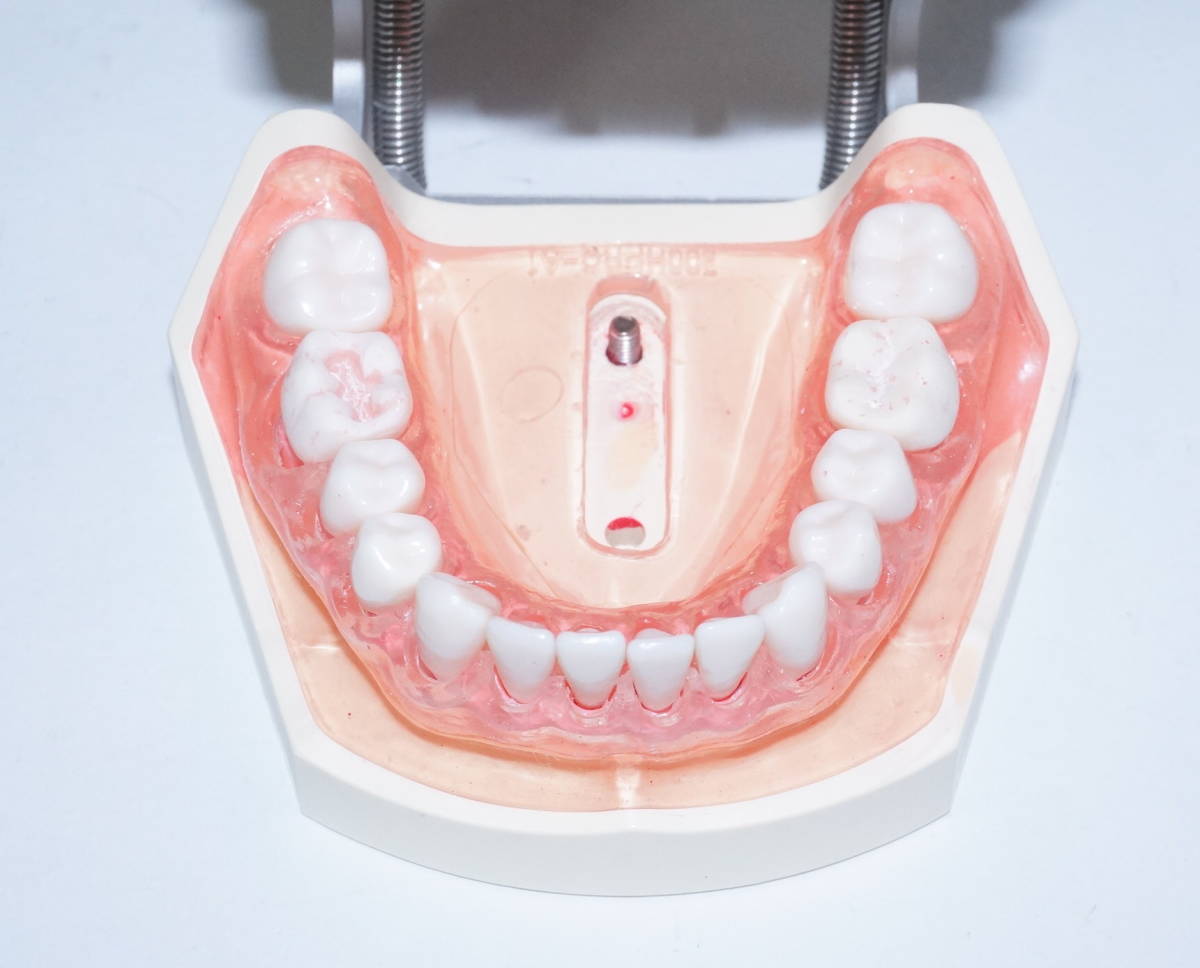 NISSIN 歯周病 歯科 模型 歯周外科 顎模型 歯科衛生士 ニッシン スケーリング スケーラー SRP 歯石 マネキン 超音波 ペリオ 舌 4_画像10