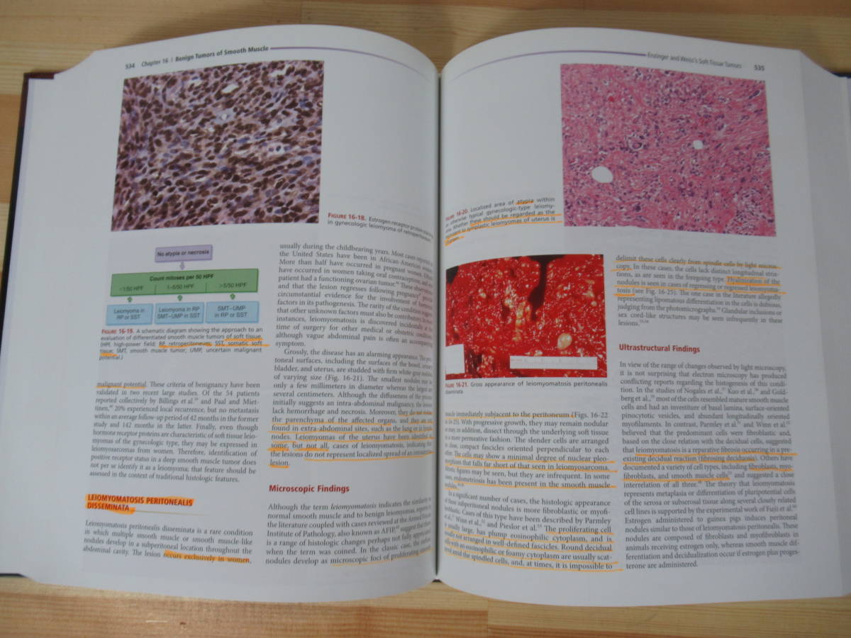M23△Enzinger and Weiss's Soft Tissue Tumors, 6th Edition 洋書 エンジンジャー&ワイス軟部腫瘍 W B Saunders Co 2013年 220518 - 医学一般 M23△Enzinger and Weiss's Soft Tissue Tumors, 6th Edition 洋書 エンジンジャー&ワイス軟部腫瘍 W B Saunders Co 2013年 220518 - 医学一般