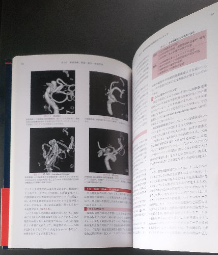 ◆◇送料無料！【脳動脈瘤の血管内治療】　「最新症例集」　多数の症例を提示◇◆_画像4