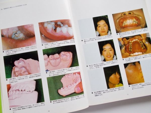 値引 絶版希少本□咬合病治療 顎関節症を「観る」心と咬合由来 歯科学