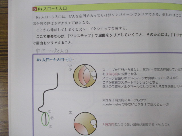 行列のできる患者にやさしい ”無痛” 大腸内視鏡挿入法_画像7