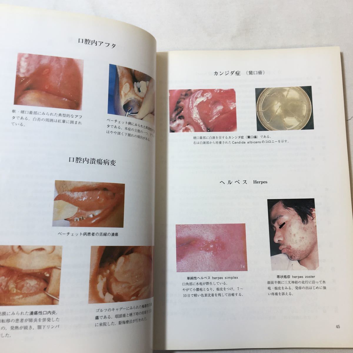 zaa-347♪視て学ぶ消化器病学「消化管」 単行本 1997/5/1 下山 孝 (編集)　診断と治療社