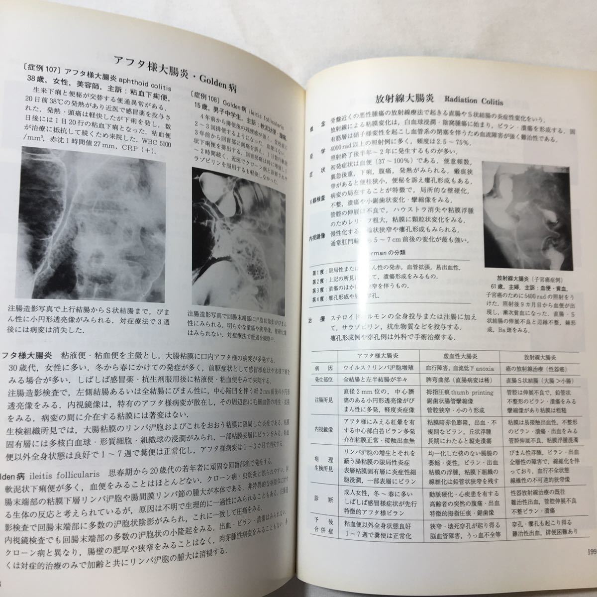 zaa-347♪視て学ぶ消化器病学「消化管」 単行本 1997/5/1 下山 孝 (編集)　診断と治療社