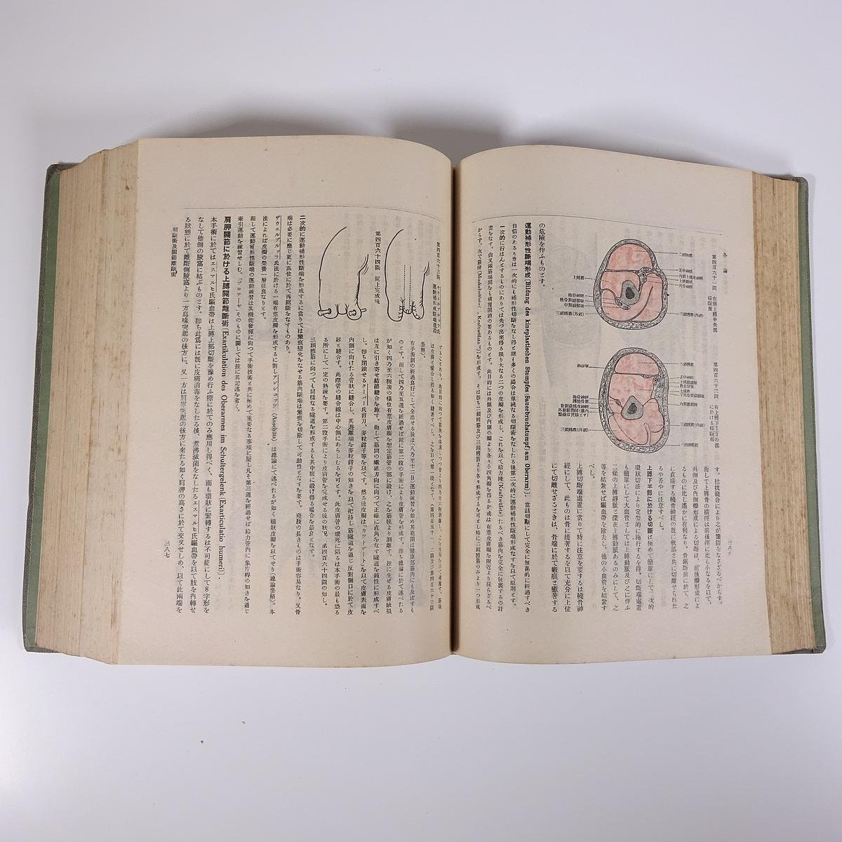 実地外科手術書 高橋信美 鈴木五郎 佐々木図書出版 昭和二三年 1948 古書 大型本 裸本 医学 医療 治療 病院 医者_画像8