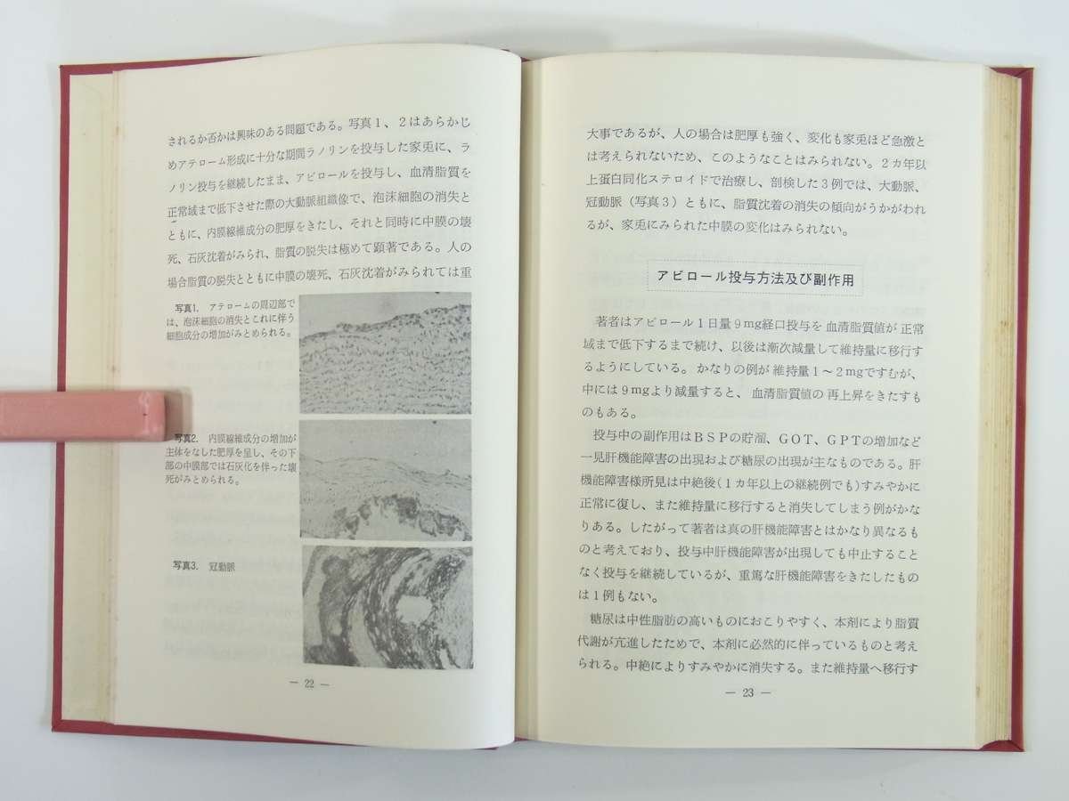 薬物療法の指針 武田薬品工業株式会社 1968 医学 医療 治療 病院 薬学 循環器系疾患 消化器系疾患 精神・神経系疾患 手術管理 ほか_画像7