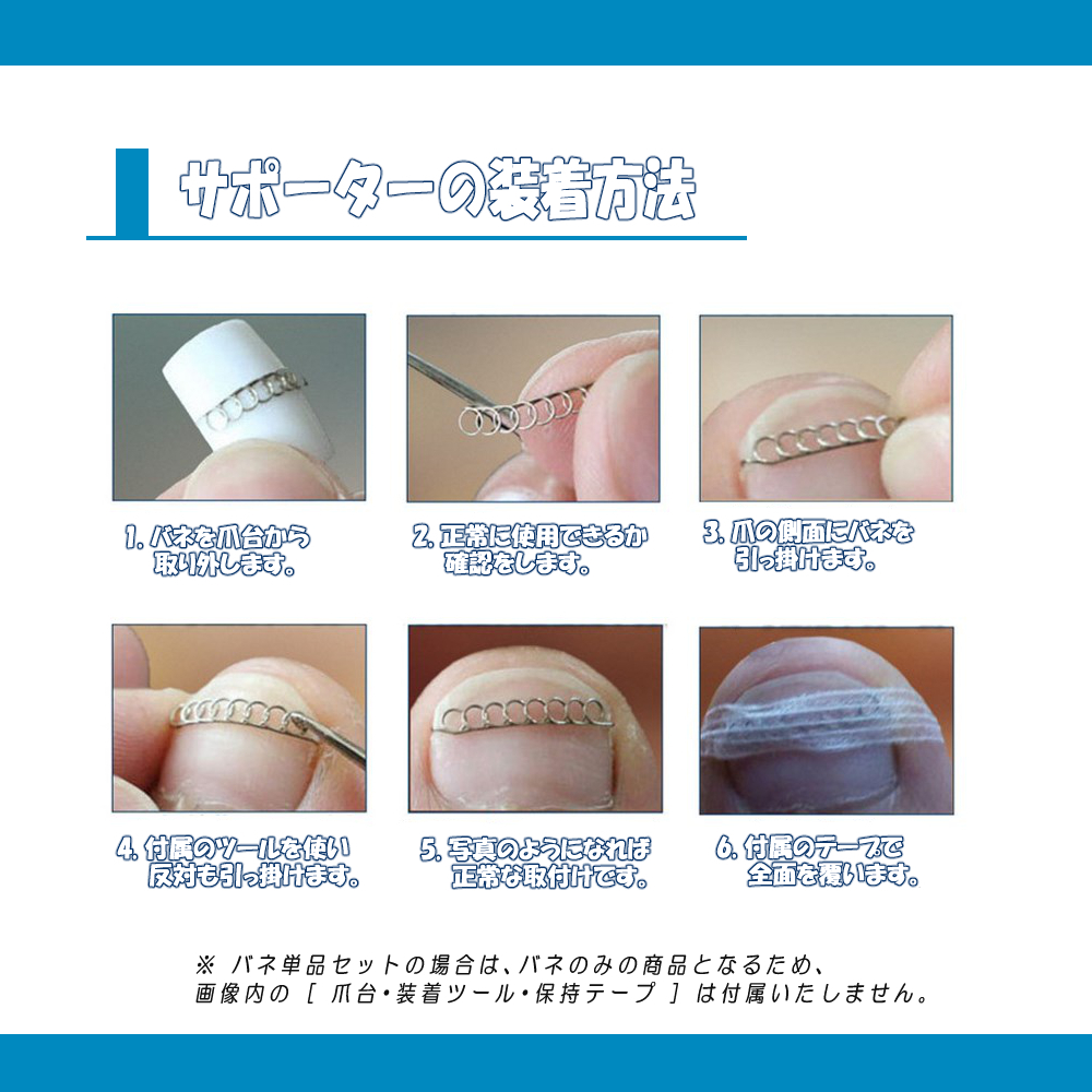 [ postage 0 jpy ] to coil nail correction kit M size postage 0 jpy 3 point set nail width 16~18mm