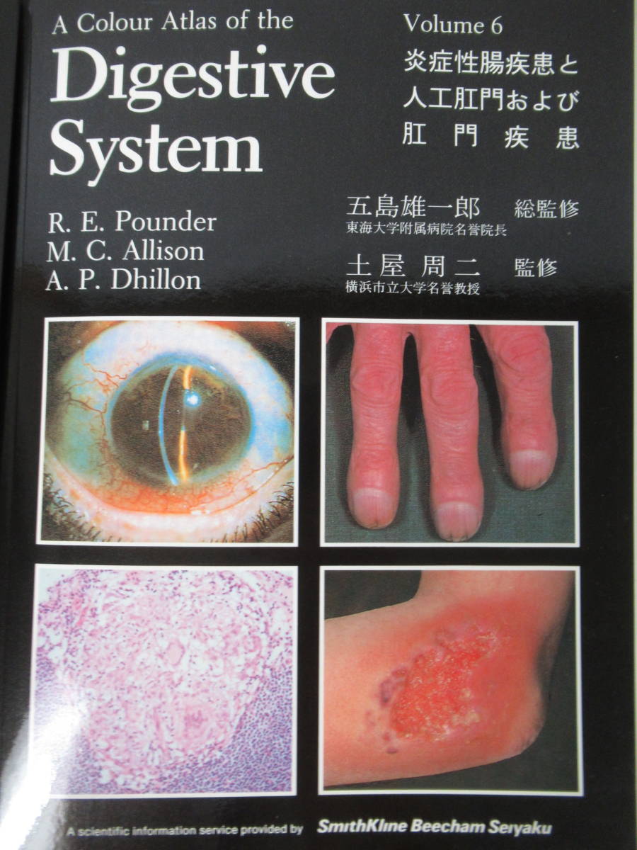 s04●A Colur Atlas of the Digestive System 日本語版 1-6巻不揃セット 五島雄一郎 出月康夫 バインダー 医学書 消化器系 正常胃 220706_画像9