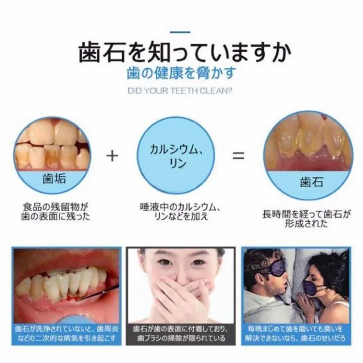 歯石取りスクレバー 歯用ツール　超音波スケーラー 口臭 ブルー