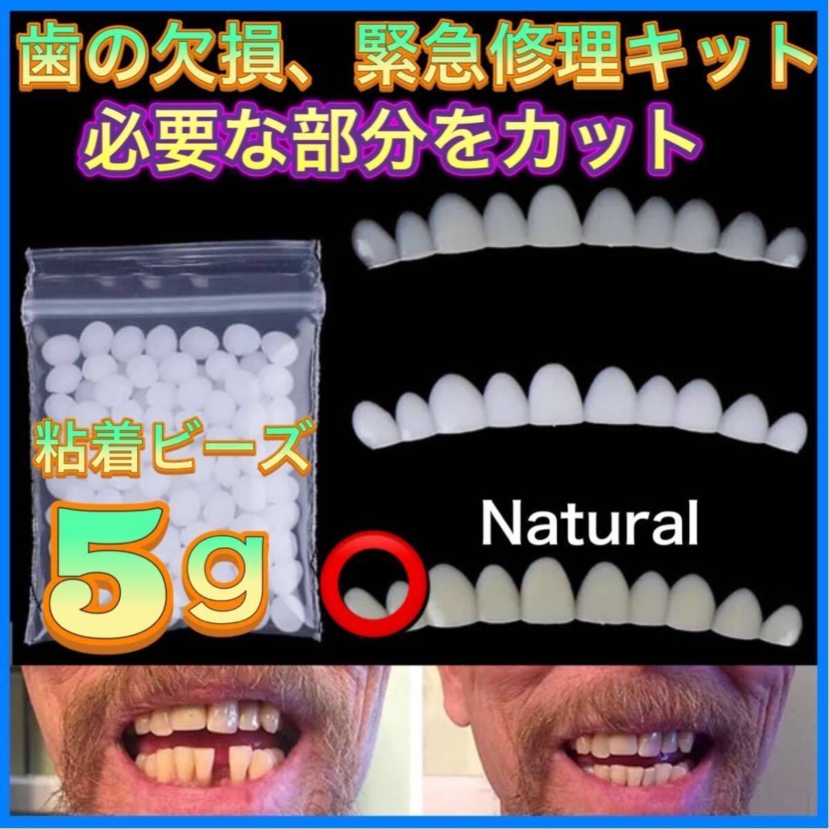 ランキング上位のプレゼント ナチュラル 粘着ビーズ5g付き テンポラリートゥース 仮歯 差し歯 入れ歯 フィッティング ランキング上位のプレゼント ナチュラル 粘着ビーズ5g付き テンポラリートゥース 仮歯 差し歯 入れ歯 フィッティング
