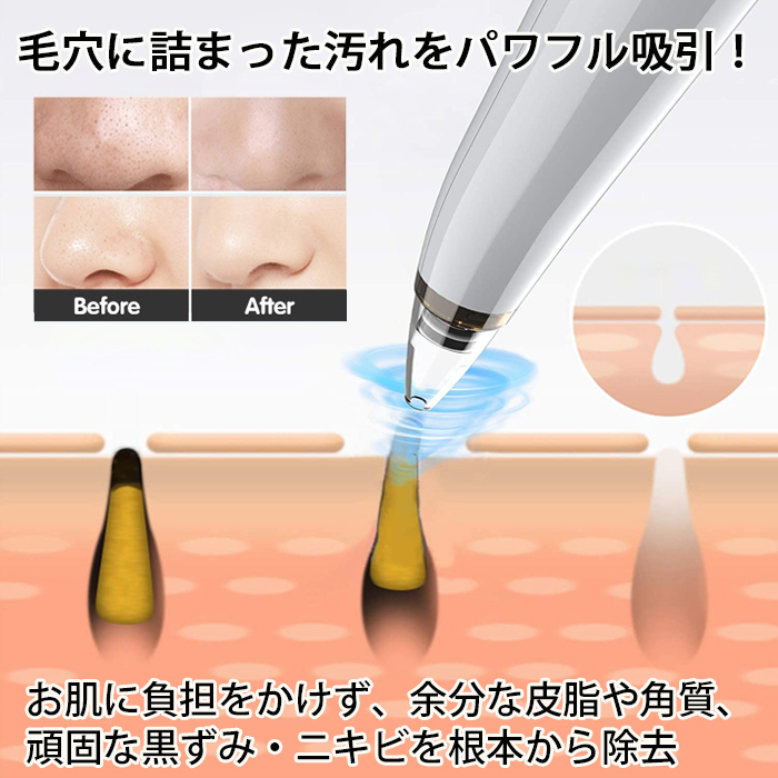 毛穴吸引器 毛穴吸引機 美顔器 EMS 黒ずみ 吸出 毛穴クリーナー 毛穴吸引 毛穴ケア###毛穴P503-WH/BK###_画像2