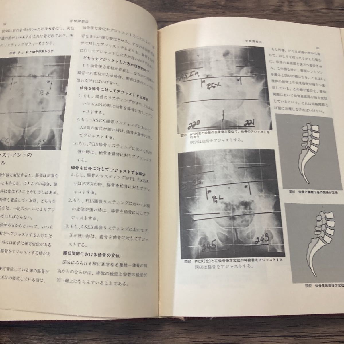 パーマー系カイロプラクティック 哲学・理論・テクニック 医学 パーマー系カイロプラクティック 哲学・理論・テクニック 医学
