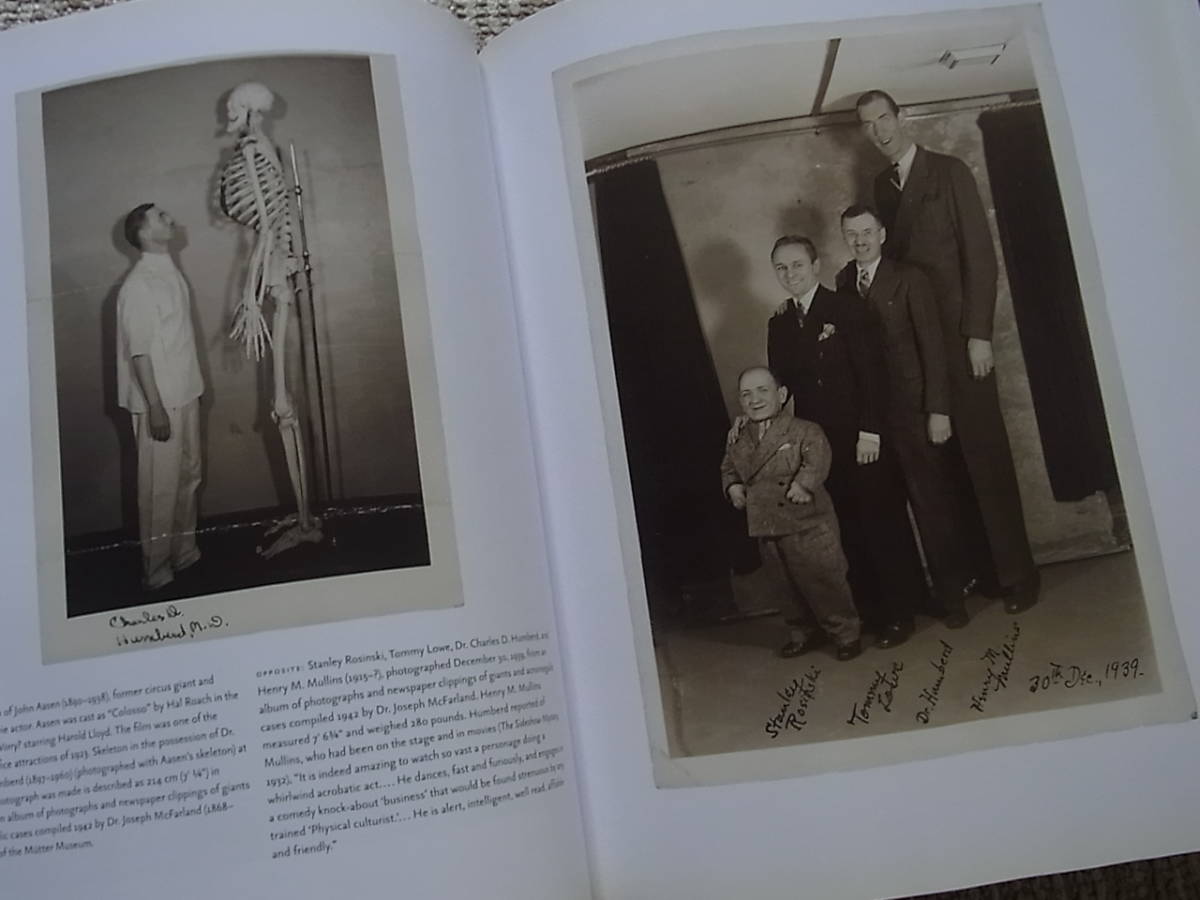 Muetter Museum ムター博物館 洋書 医学 解剖 奇形 骨格 標本 2 Muetter Museum ムター博物館 洋書 医学 解剖 奇形 骨格 標本 2