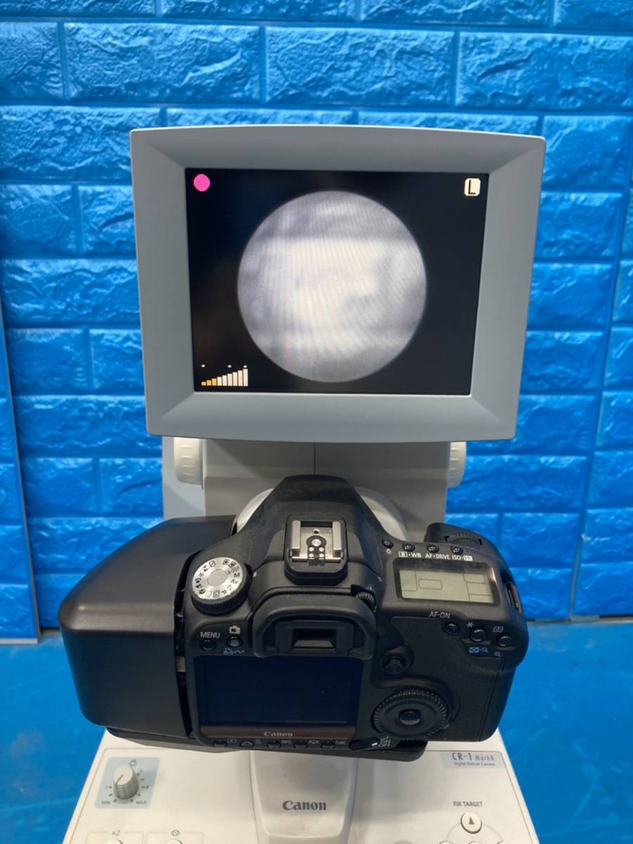 Canon 無散瞳型眼底カメラ CR-1 キヤノン(検査、測定器)｜売買されたオークション情報、yahooの商品情報をアーカイブ公開 -  オークファン（aucfan.com）