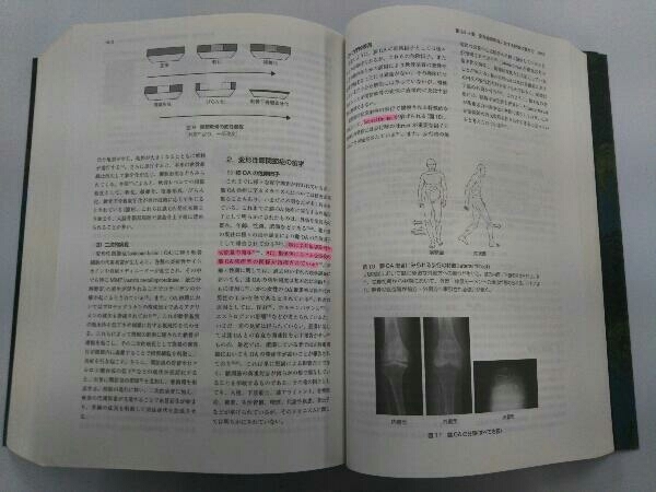 理学療法ハンドブック 改訂第4版 全4巻セット 細田多穂_画像9