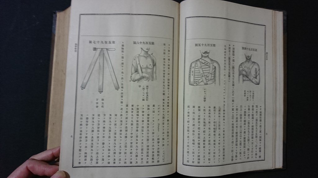 ｖ＃＃　明治期書籍　智児曼斯氏 外科各論 乾　田代義徳　坂野蔵書　南江堂　明治30年　厚冊　古書/A07_画像4