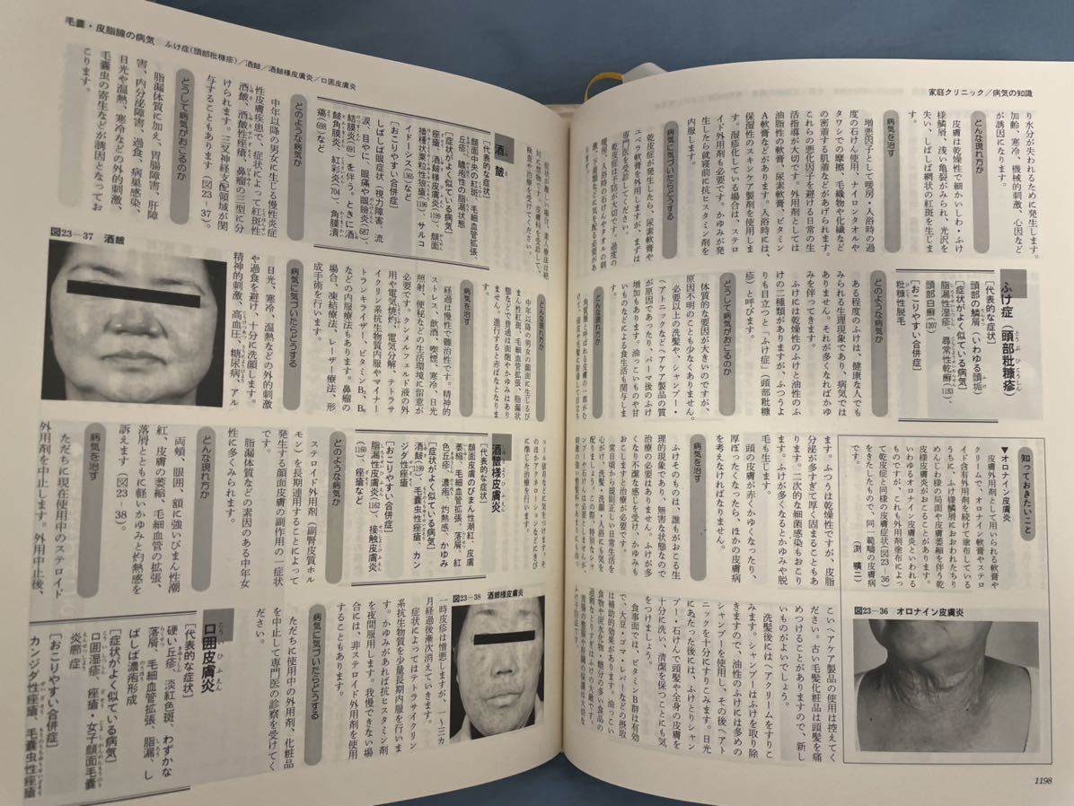 家庭医学大全科　改訂新版　箱入り　BIG DOCTOR　家庭の医学事典_画像4