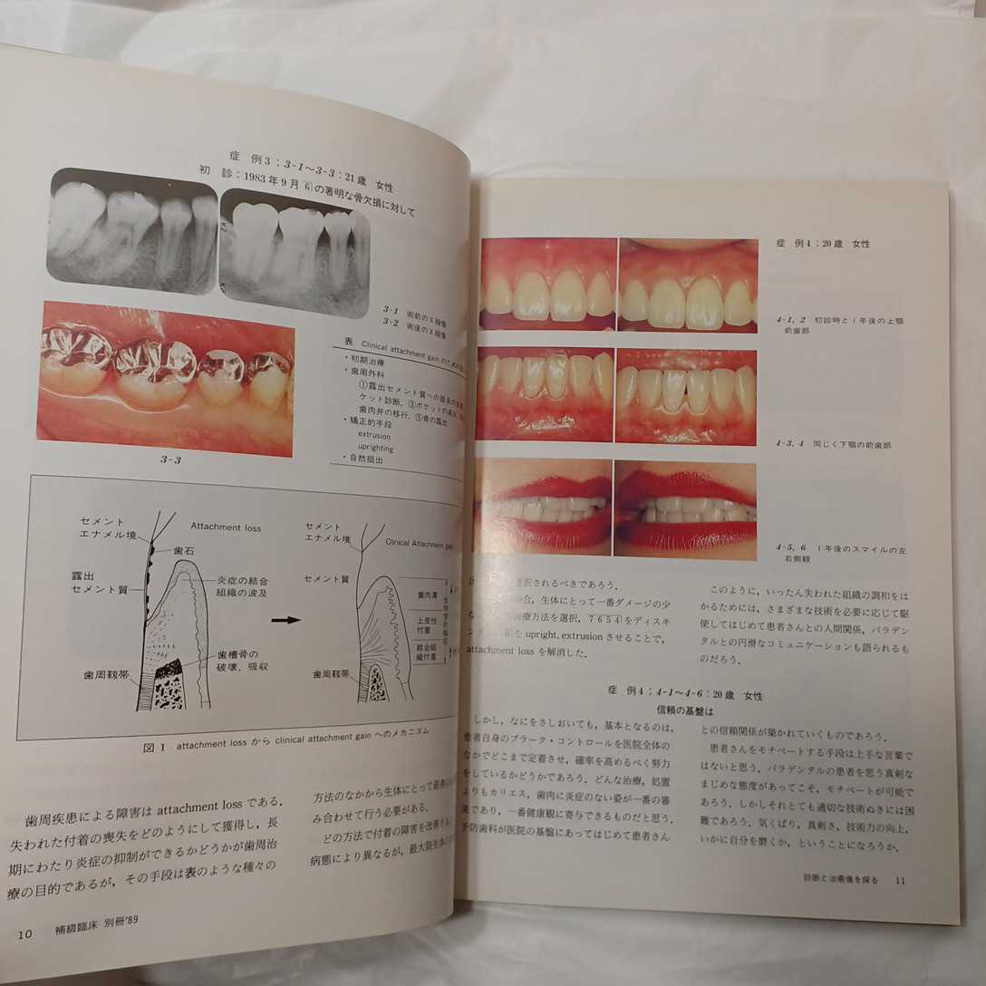 zaa-394♪「補綴臨床」別冊 診断と治癒像を探る―21世紀の補綴臨床に向けて　医歯薬出版社：1989年_画像4