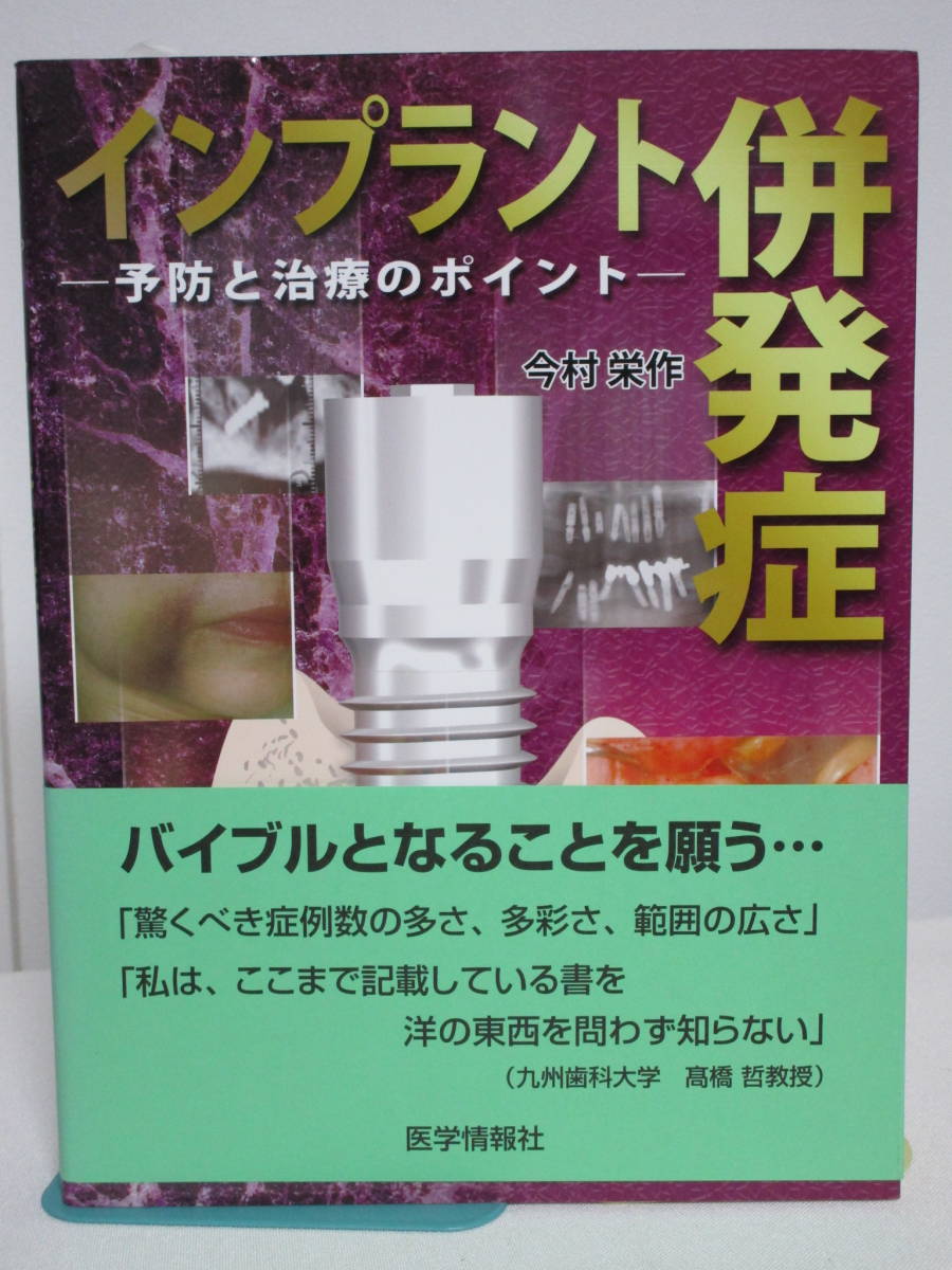 ％品質 インプラント 症例 治療 医学情報社歯科 予防と治療の