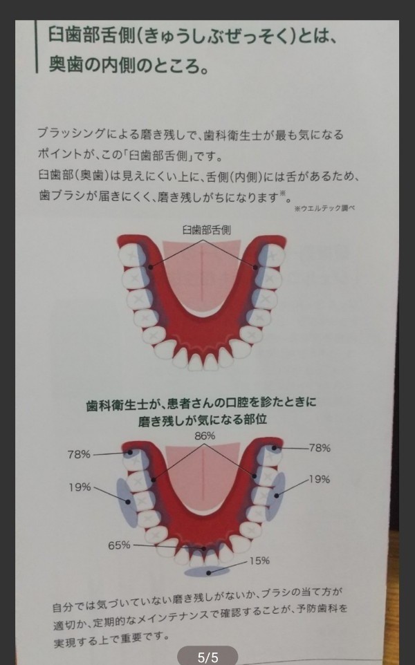 本店は 本日限定価格 新品未使用 奥歯フィット歯ブラシ コンクール