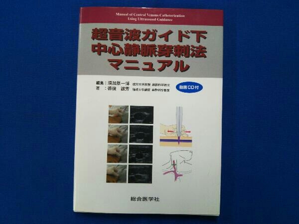 超音波ガイド下 中心静脈穿刺法マニュアル 須加原一博_画像1