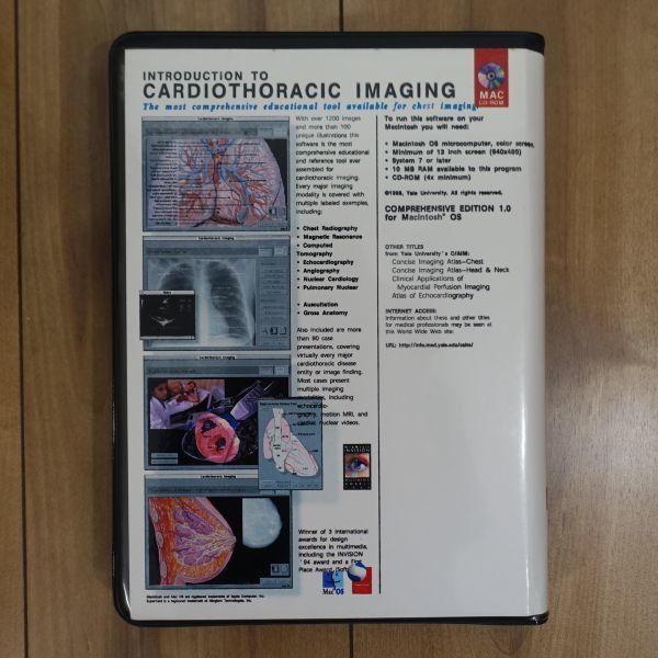 Introduction To Cardiothoracic Imaging 心臓写真 (Yale University) Mac_画像6