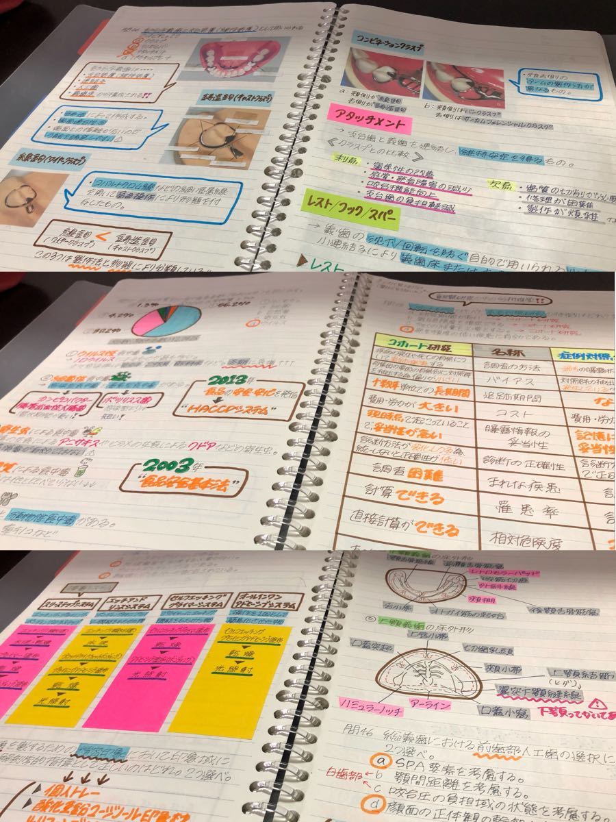 歯科衛生士国家試験 まとめノート 自己流