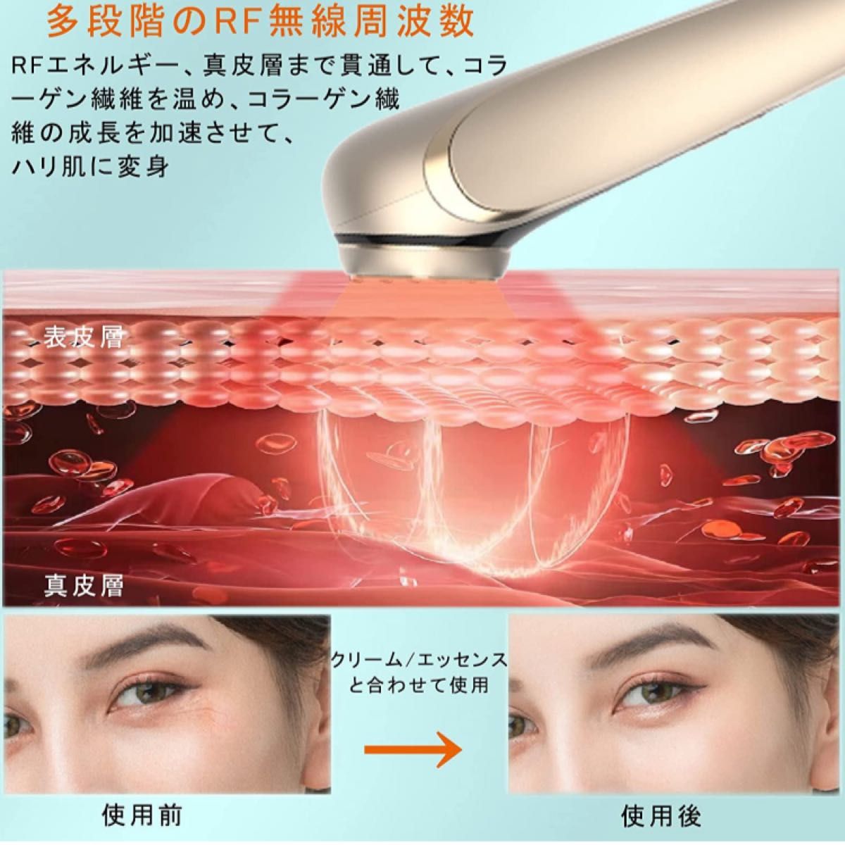 美顔器 RF美顔器 イオン導出 イオン導入 EMS 微電流 LED搭載 1台 | 超