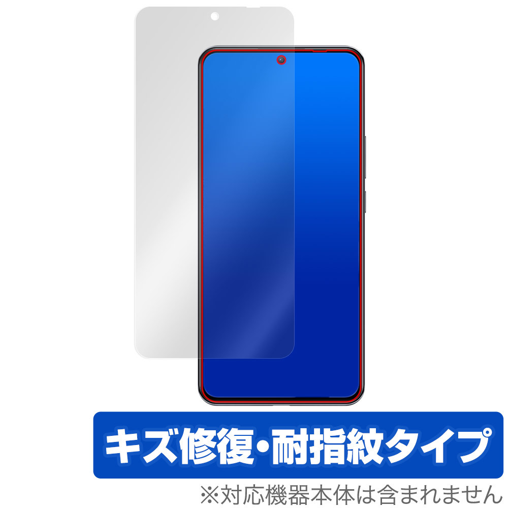 Xiaomi 12T Pro SoftBank A201XM 保護 フィルム OverLay Magic シャオミー スマートフォン 液晶保護 傷修復 耐指紋 指紋防止 コーティング_画像1
