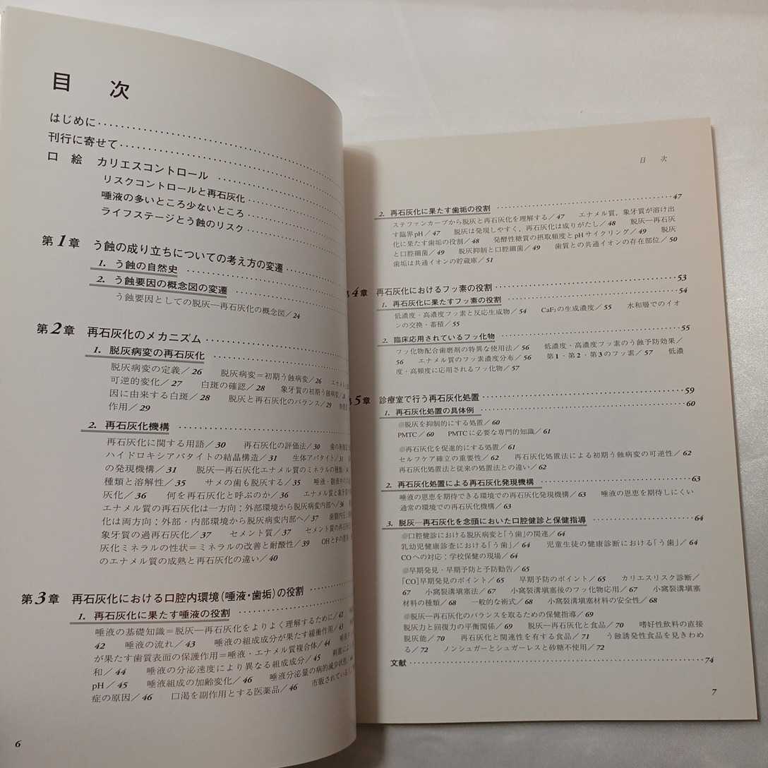 zaa-409♪カリエスコントロール - 脱灰と再石灰化のメカニズム 飯島洋一（歯学）/熊谷崇 医歯薬出版（1999/05発売）