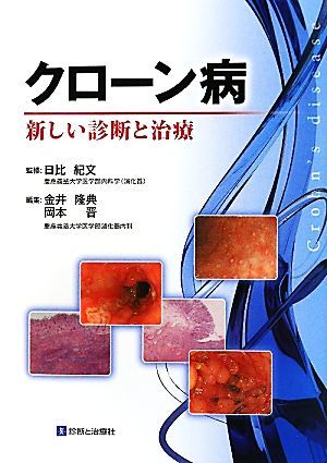 クローン病 新しい診断と治療／日比紀文【監修】，金井隆典，岡本晋【編】_画像1