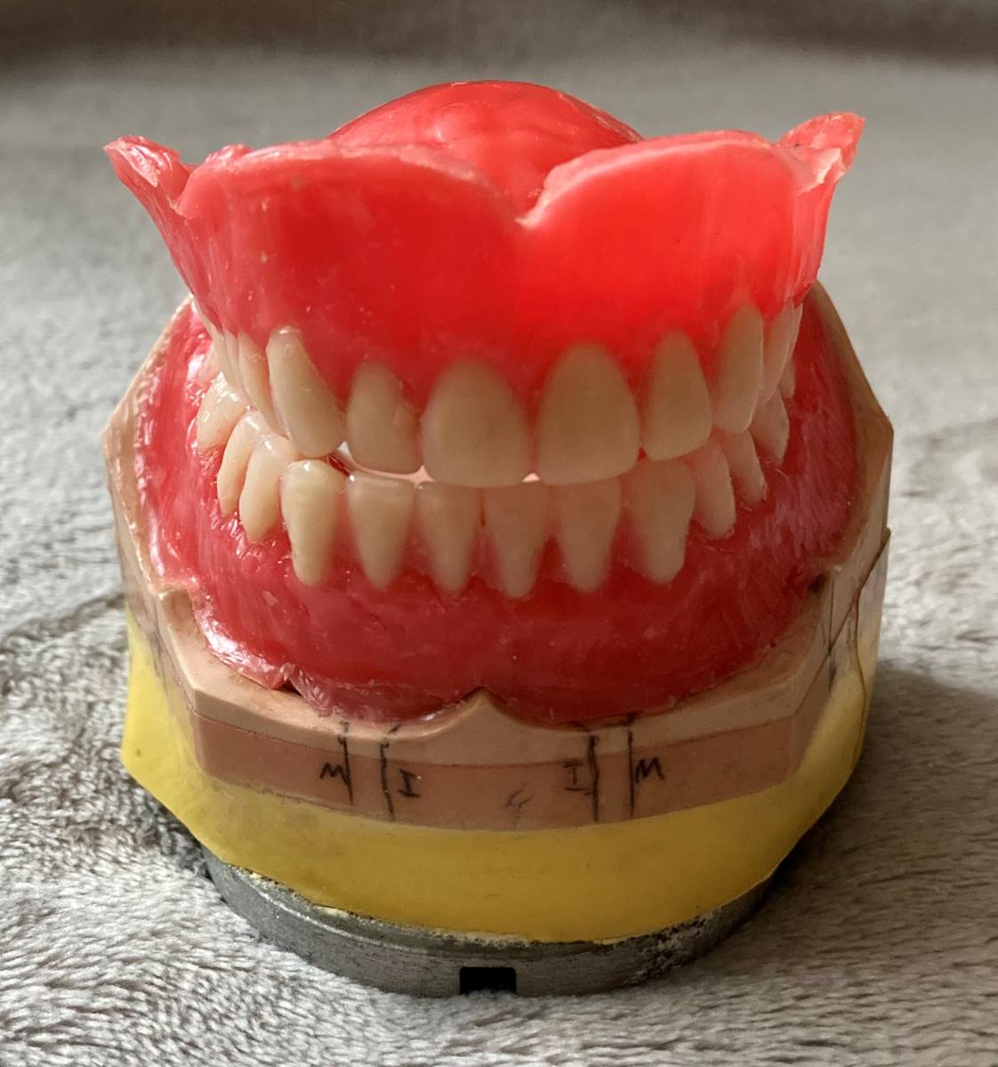 ヤフオク 歯科技工 入れ歯 サンプル 義歯 歯科模型
