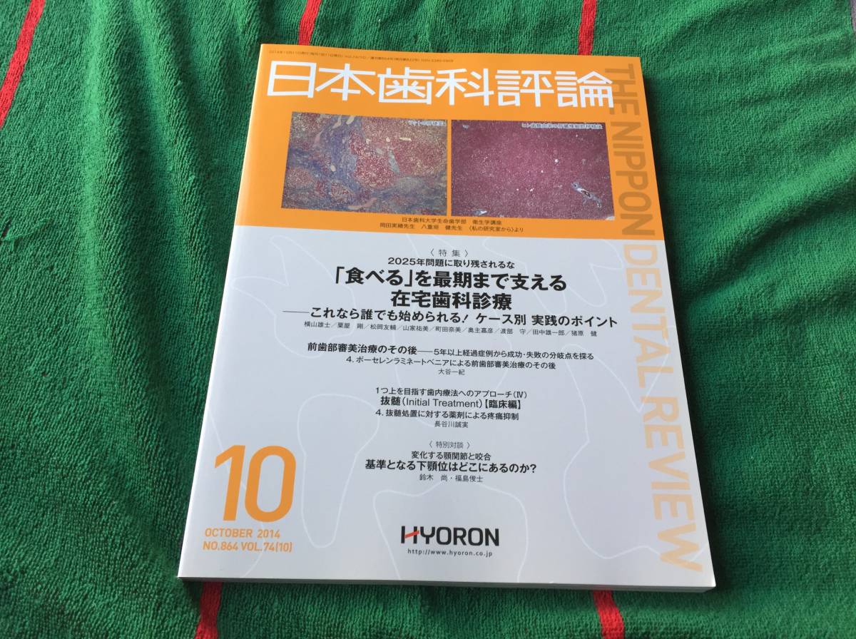 雑誌 日本歯科評論 2014年10月号 No.864_画像1