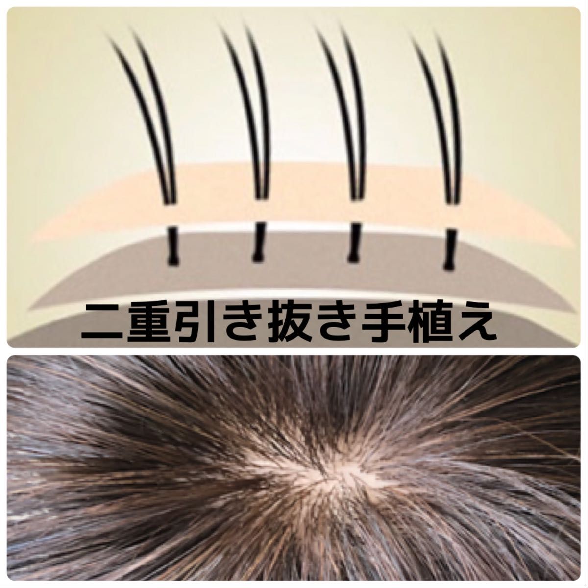 【26cmタイプ】前髪付き総手植え人毛100%ナチュラルブラック　ヘアピース