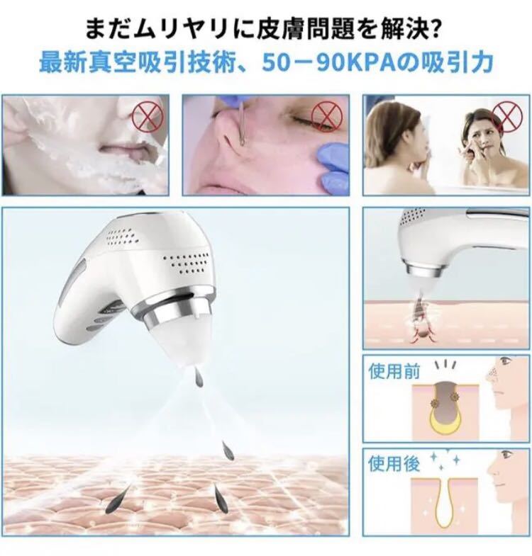 毛穴吸引器 美顔器 毛穴クリーナー 温冷ケア 3段階吸引力 4種類シリコンヘッド_画像6